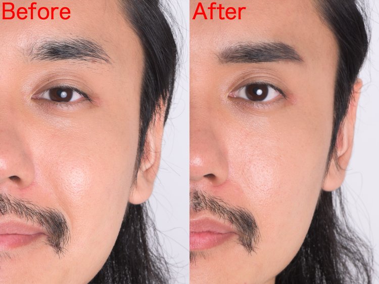 Before & Afterで比べれば、どっちがイケてるか一目瞭然!