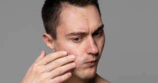 オイリー肌とは？改善するために意識したいポイント&おすすめ商品を紹介