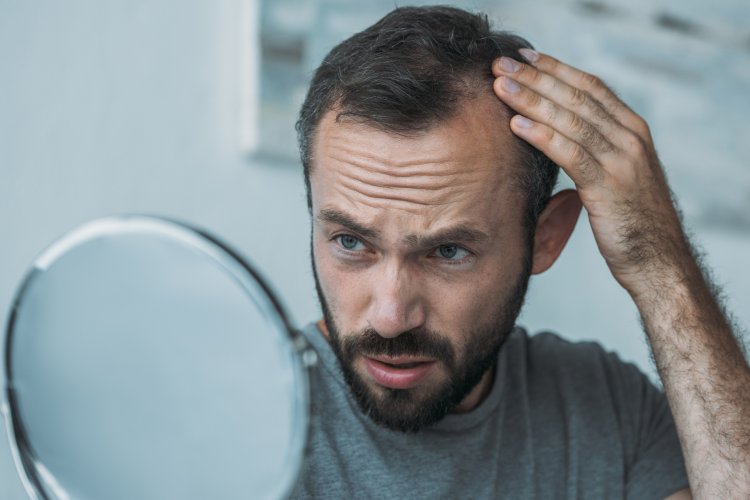 How can I recognize the first signs of baldness in the forelock?