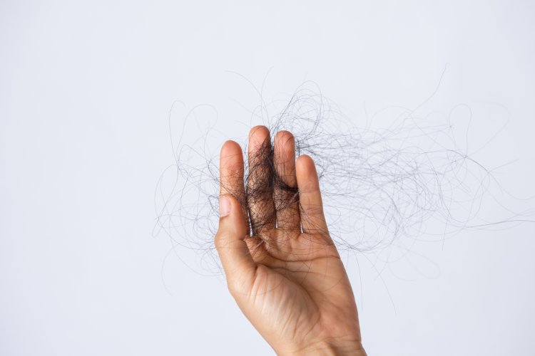 前髪はげの主な原因③「頭皮への物理的なダメージによる脱毛症」