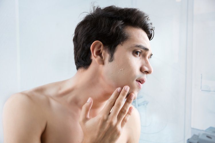 男の肌はとにかく皮脂分泌が多い！汚れをしっかり落とさないと肌荒れの原因に