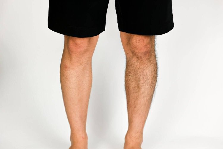 When wearing shorts, do not forget to remove the shin hair!