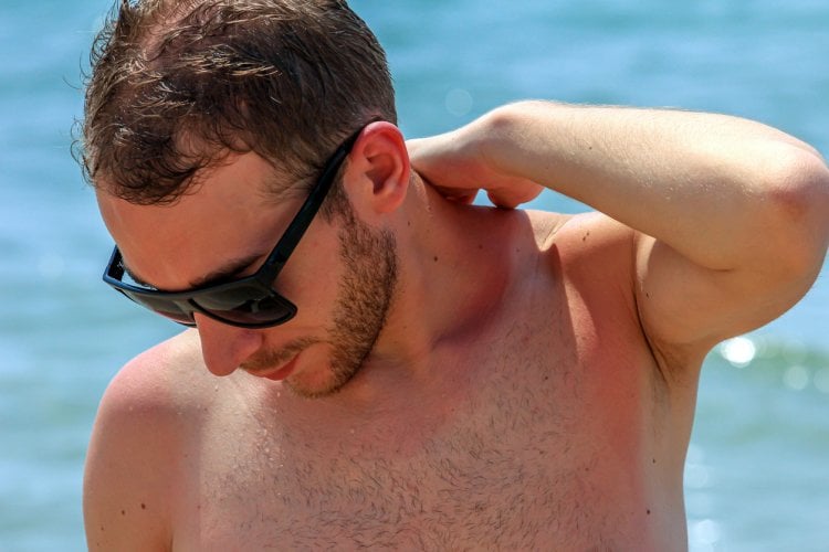 What is the point of wearing sunscreen?